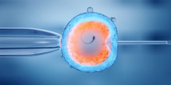 IVF/
