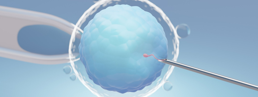 Intracytoplasmic Sperm Injection